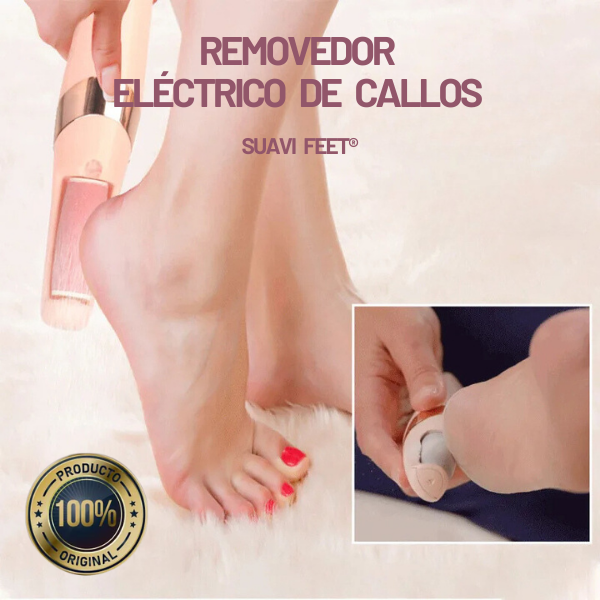 Removedor Eléctrico de Callos Suavi Feet®