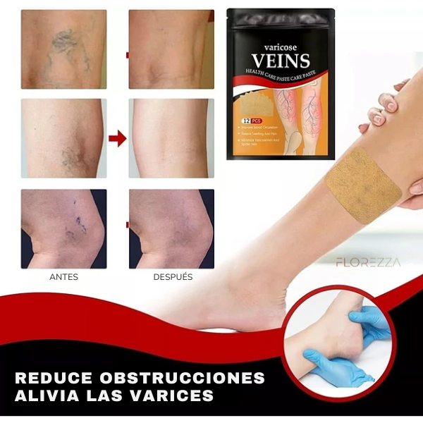 Parches para Várices VitalLeg™