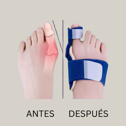 Corrector Pro™