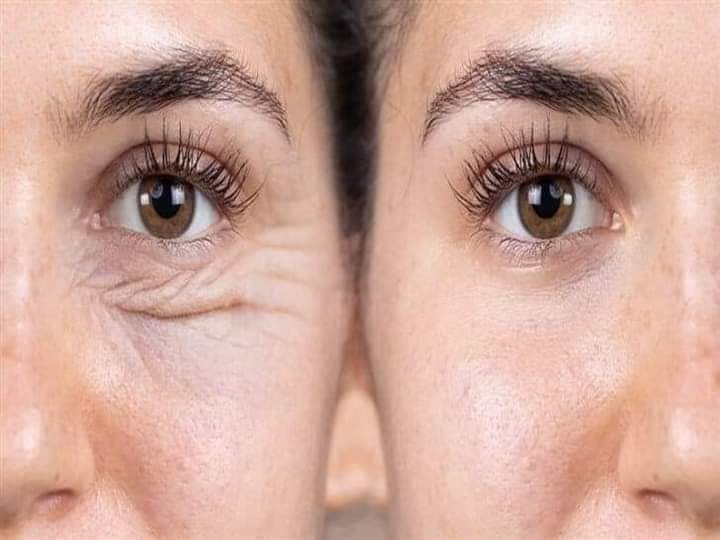 Crema Reafirmante Contorno de Ojos [Vitamina C]