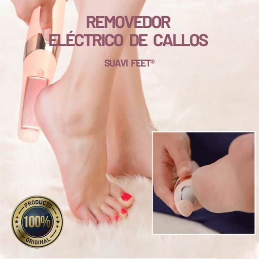 Removedor Eléctrico de Callos Suavi Feet®