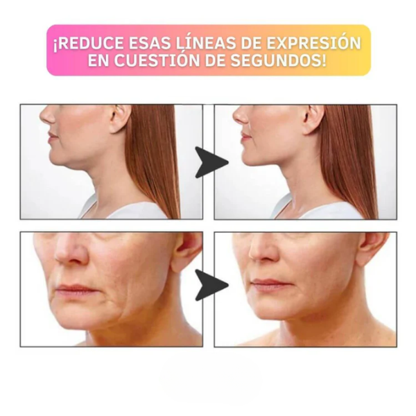 Parches Faciales Secret Lift®