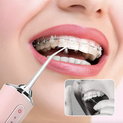Limpiador de Dientes Inalámbrico