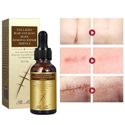 2x1 Collagen Scar© - Recupera tu confianza y la salud de tu piel