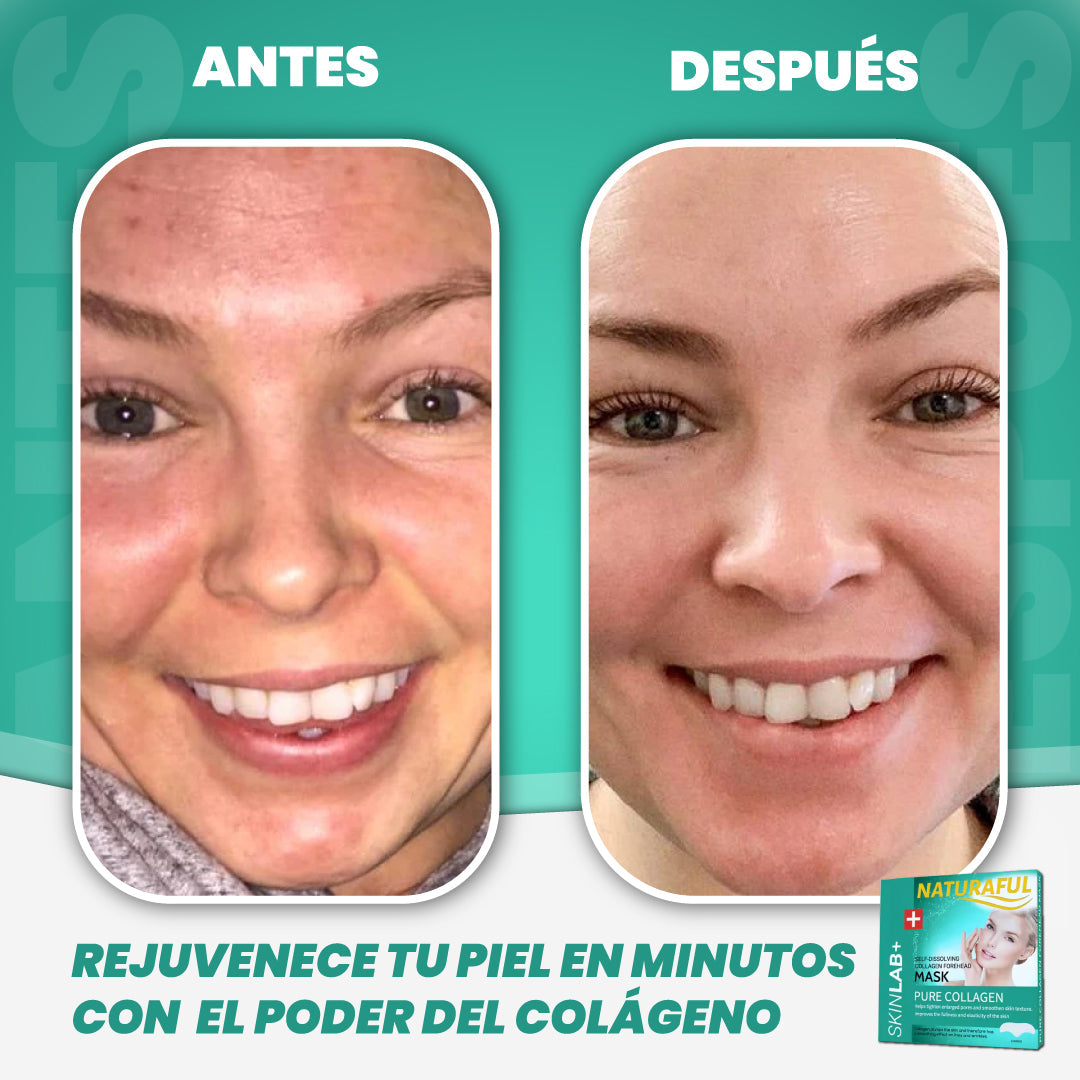 Parches de Colágeno Absorbentes Naturaful™